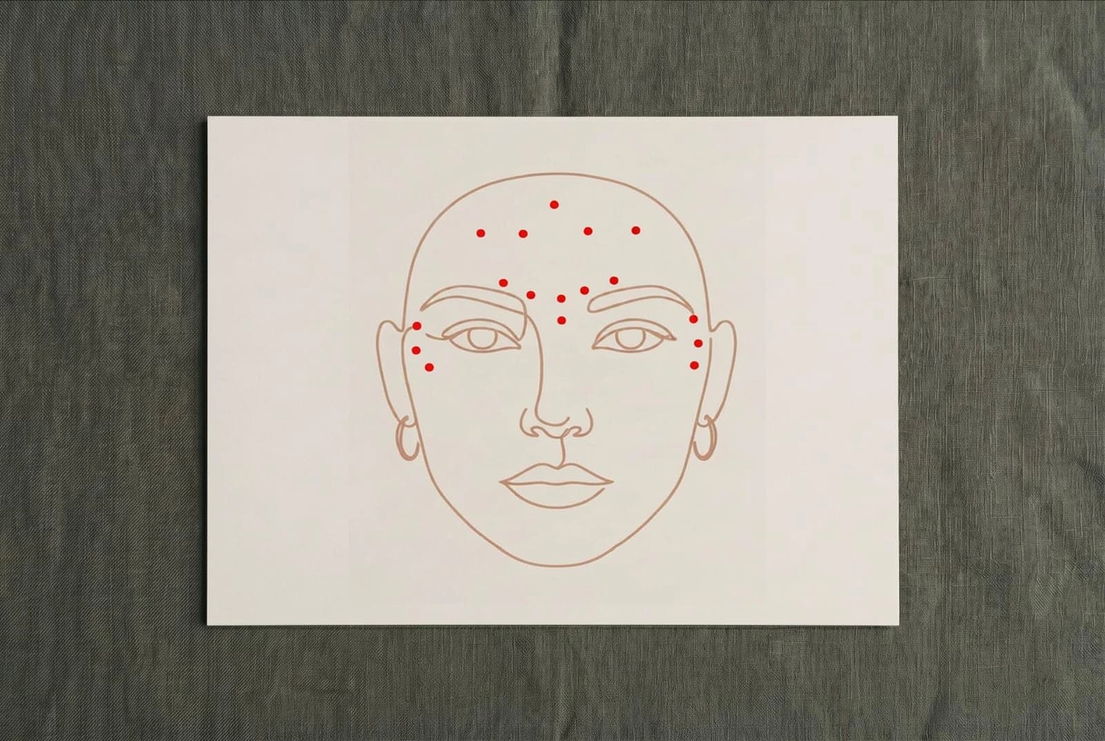 Minimalistische Linienzeichnung eines Gesichts mit roten Punkten an den typischen Botox-Arealen (Stirn, Glabella, Krähenfüße) — Praxis Ästhetik am Isartor München
